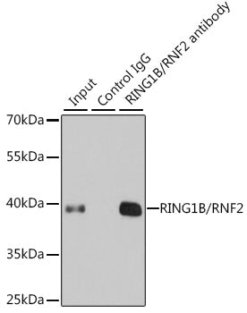 RING1B/RNF2 Rabbit pAb