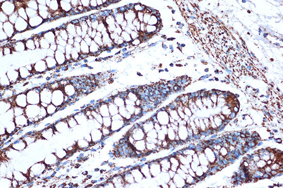 HSPE1/HSP10/CPN10 Rabbit mAb