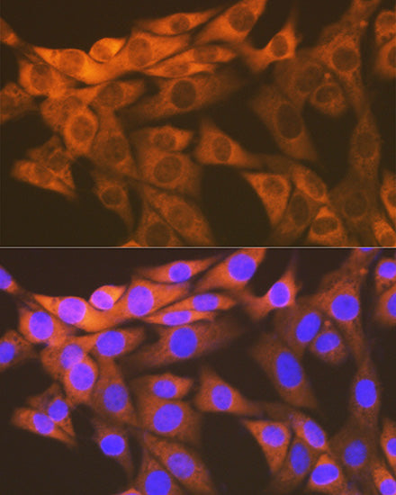 HSPE1/HSP10/CPN10 Rabbit mAb
