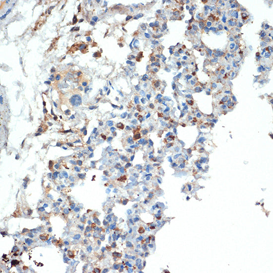Cystatin A Rabbit mAb