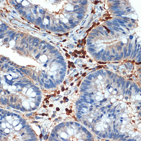 Cystatin A Rabbit mAb