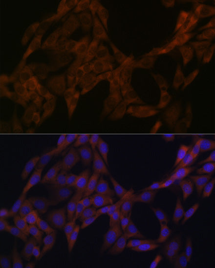Cystatin A Rabbit mAb