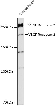 VEGF Receptor 2 Rabbit pAb