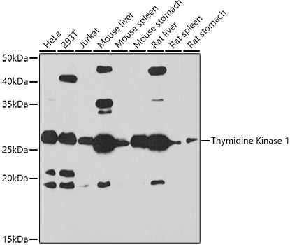 Thymidine Kinase 1 Rabbit pAb