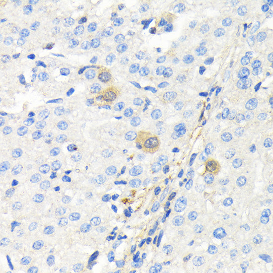 Thymidine Kinase 1 Rabbit pAb