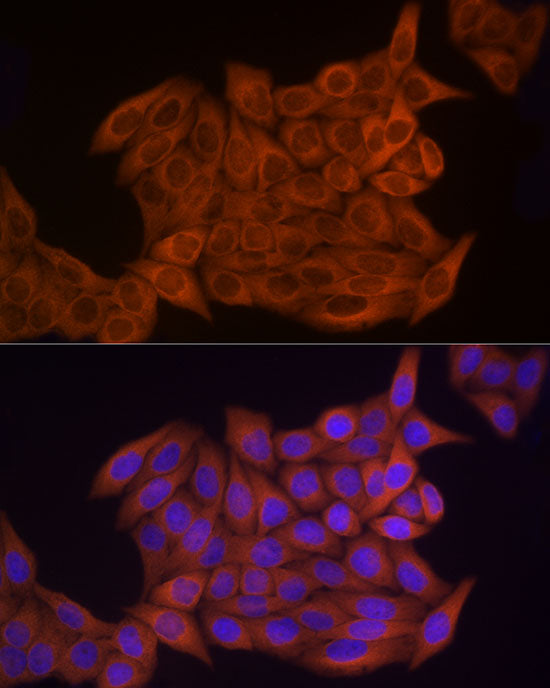Thymidine Kinase 1 Rabbit pAb