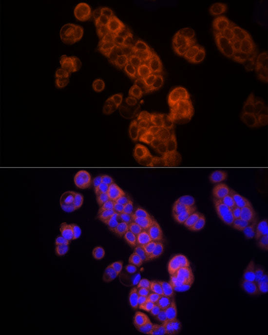 Thymidine Kinase 1 Rabbit pAb