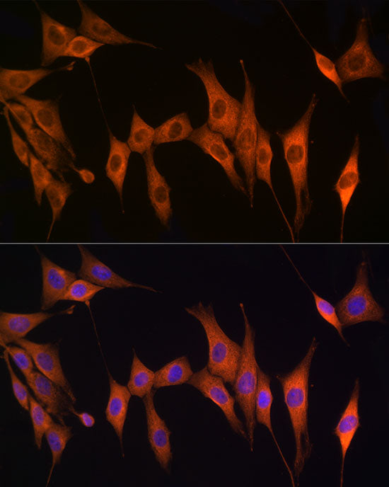 Thymidine Kinase 1 Rabbit pAb