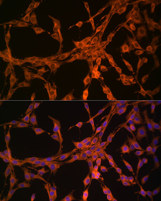 Thymidine Kinase 1 Rabbit pAb