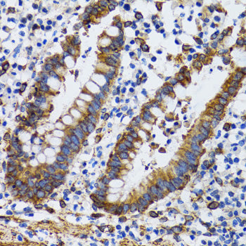 PGRMC1 Rabbit pAb