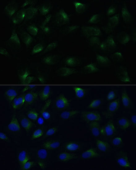 PGRMC1 Rabbit pAb