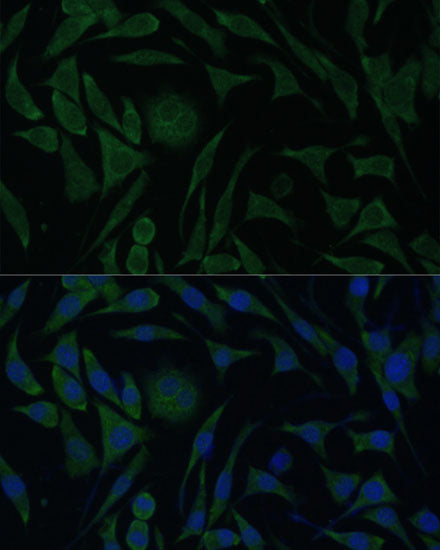 PGRMC1 Rabbit pAb