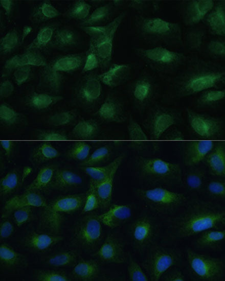 PGRMC1 Rabbit pAb