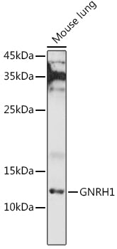 GNRH1 Rabbit pAb