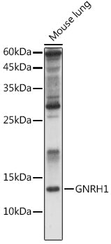 GNRH1 Rabbit pAb
