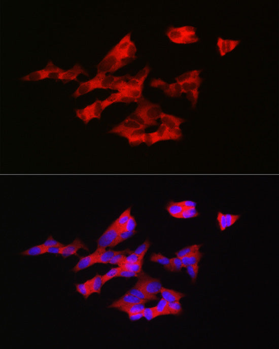 GNRH1 Rabbit pAb