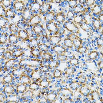 [KO Validated] α-Catenin Rabbit pAb