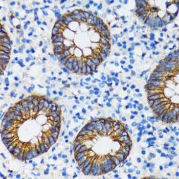 [KO Validated] α-Catenin Rabbit pAb