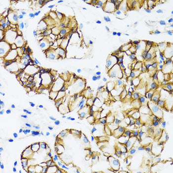 [KO Validated] α-Catenin Rabbit pAb