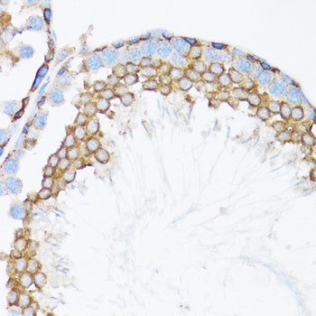 [KO Validated] α-Catenin Rabbit pAb