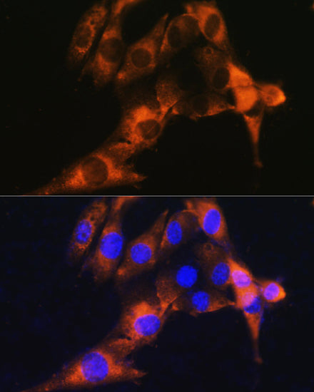 CD13/ANPEP Rabbit pAb