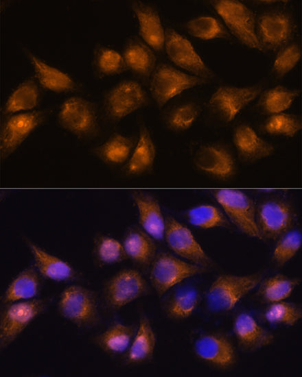 CD13/ANPEP Rabbit pAb