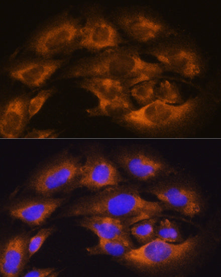 CD13/ANPEP Rabbit pAb