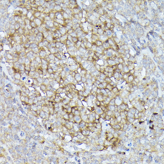 CD10/MME Rabbit pAb