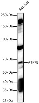 ATP7B Rabbit pAb