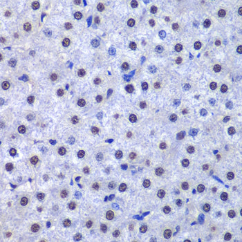 GST3/GSTP1 Rabbit pAb