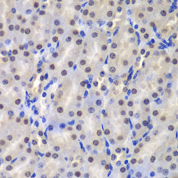 GST3/GSTP1 Rabbit pAb