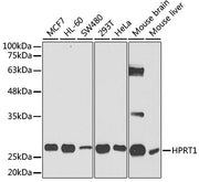 [KO Validated] HPRT1 Rabbit pAb