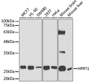 [KO Validated] HPRT1 Rabbit pAb