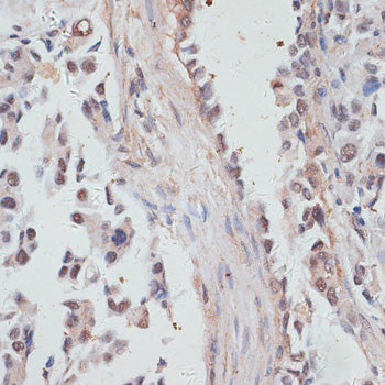NCOA4 Rabbit pAb
