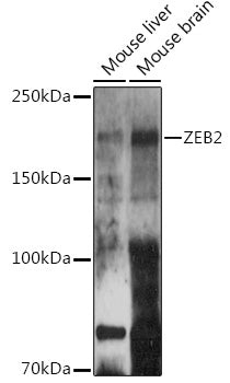 ZEB2 Rabbit pAb