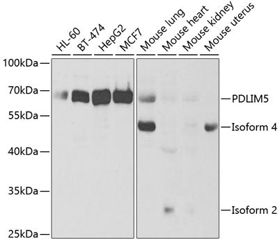 PDLIM5 Rabbit pAb