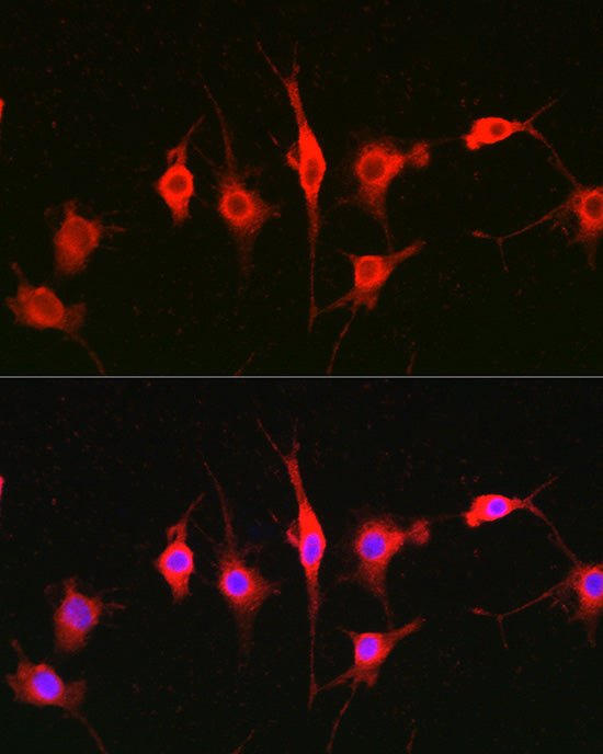 Heparanase 1 Rabbit pAb