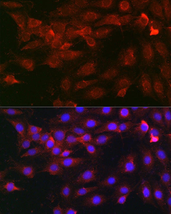 Heparanase 1 Rabbit pAb