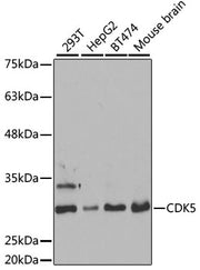 [KO Validated] CDK5 Rabbit pAb
