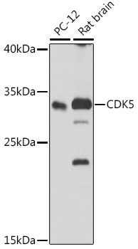 [KO Validated] CDK5 Rabbit pAb
