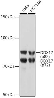 DDX17 Rabbit mAb