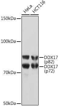 DDX17 Rabbit mAb