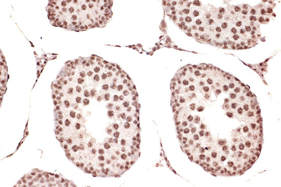 DDX17 Rabbit mAb