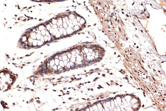 DDX17 Rabbit mAb