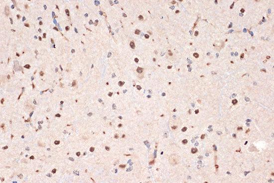 DDX17 Rabbit mAb