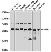 PRPF31 Rabbit pAb