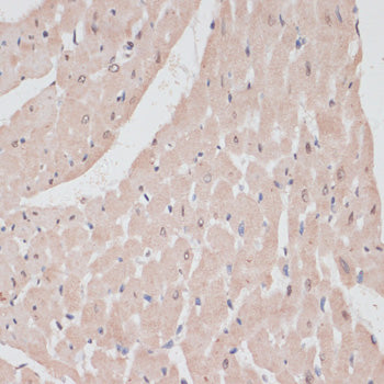 PRPF31 Rabbit pAb