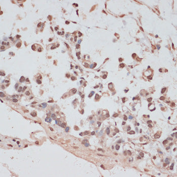 PRPF31 Rabbit pAb