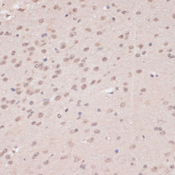 PRPF31 Rabbit pAb
