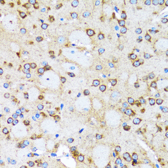 Arp2 Rabbit pAb